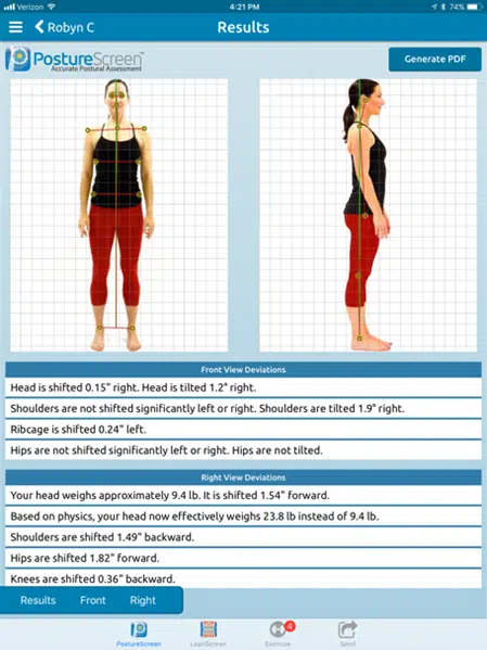 Chiropractic Services in Dublin - back pain